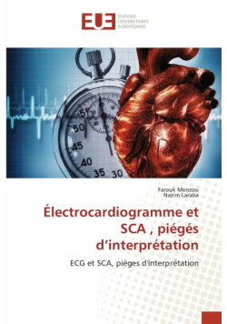Électrocardiogramme et SCA , piégés d'interprétation
