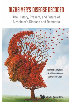 Alzheimer's Disease Decoded