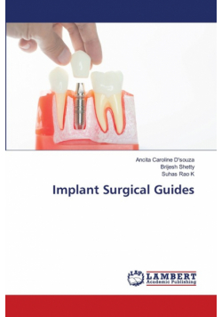 Implant Surgical Guides