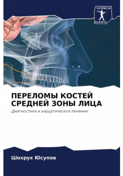 ПЕРЕЛОМЫ КОСТЕЙ СРЕДНЕЙ ЗОНЫ ЛИЦА