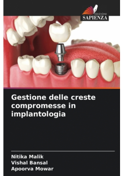 Gestione delle creste compromesse in implantologia