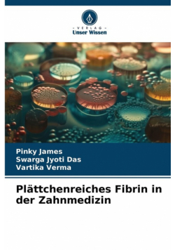 Plättchenreiches Fibrin in der Zahnmedizin