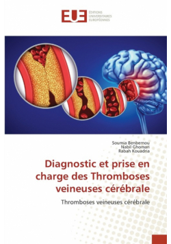 Diagnostic et prise en charge des Thromboses veineuses cérébrale