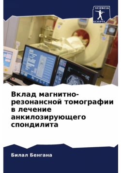 Вклад магнитно-резонансной томографии в лечение анкилозирующего спондилита
