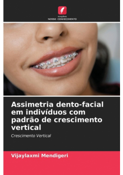 Assimetria dento-facial em indivíduos com padrão de crescimento vertical
