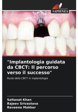 "Implantologia guidata da CBCT