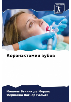 Коронэктомия зубов