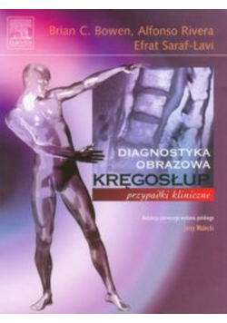 Kręgosłup Przypadki kliniczne