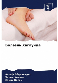 Болезнь Хаглунда