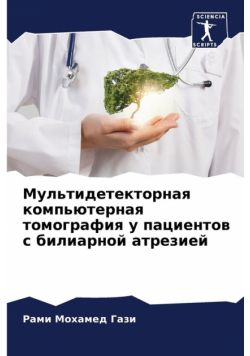Мультидетекторная компьютерная томография у пациентов с билиарной атрезией