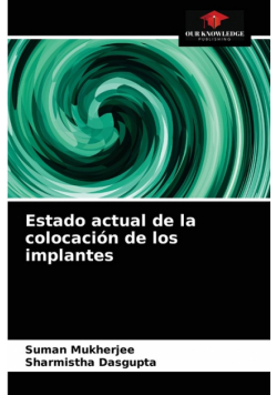 Estado actual de la colocación de los implantes