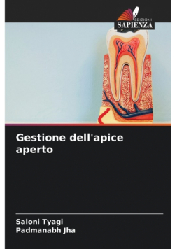 Gestione dell'apice aperto