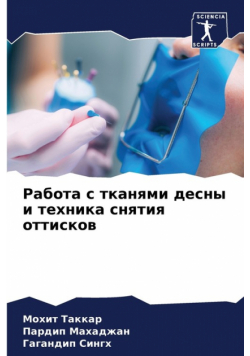 Работа с тканями десны и техника снятия оттисков