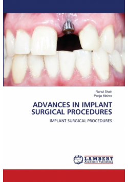 Advances In Implant Surgical Procedures