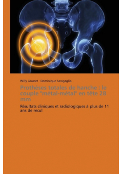 Prothèses totales de hanche