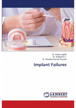 Implant Failures
