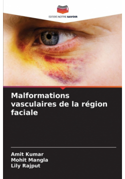 Malformations vasculaires de la région faciale