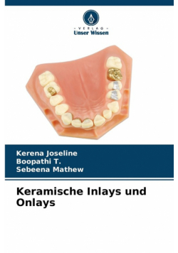 Keramische Inlays und Onlays