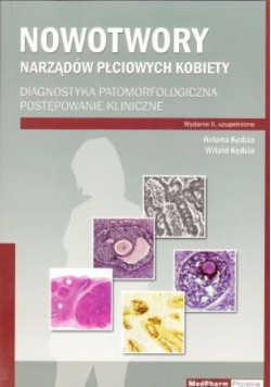 Nowotwory Narządów Płciowych Kobiety