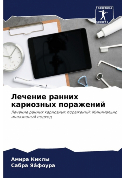 Лечение ранних кариозных поражений