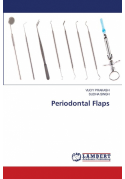 Periodontal Flaps