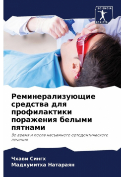 Реминерализующие средства для профилактики поражения белыми пятнами
