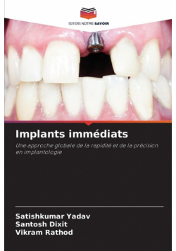Implants immédiats