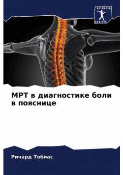 МРТ в диагностике боли в пояснице