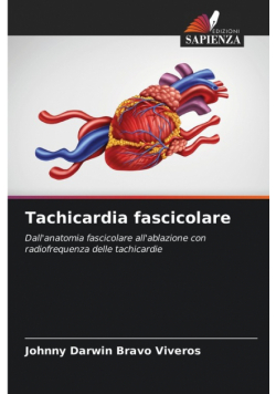 Tachicardia fascicolare
