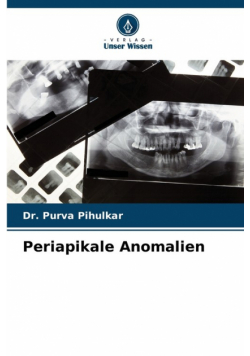 Periapikale Anomalien