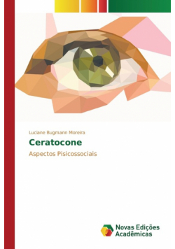 Ceratocone
