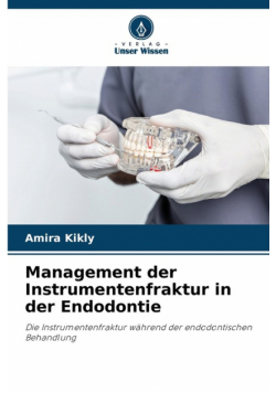 Management der Instrumentenfraktur in der Endodontie