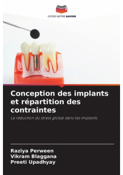 Conception des implants et répartition des contraintes