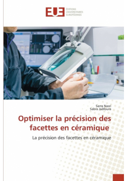 Optimiser la précision des facettes en céramique