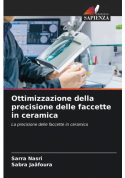 Ottimizzazione della precisione delle faccette in ceramica