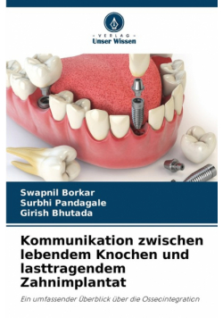 Kommunikation zwischen lebendem Knochen und lasttragendem Zahnimplantat