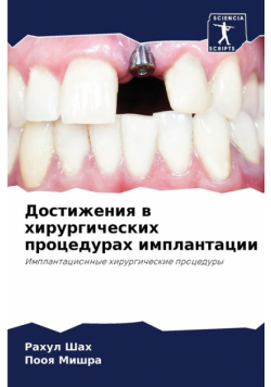 Достижения в хирургических процедурах имплантации