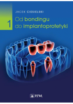 Od bondingu do implantoprotetyki Część 1