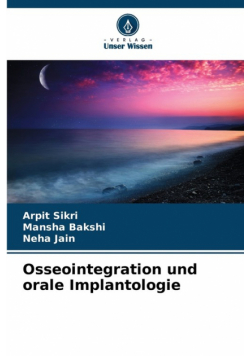 Osseointegration und orale Implantologie