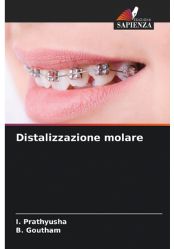 Distalizzazione molare