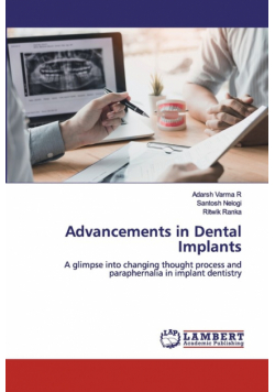 Advancements in Dental Implants