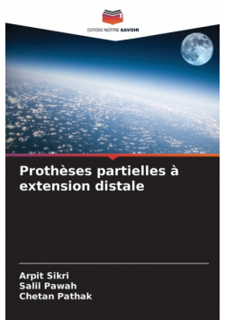 Prothèses partielles à extension distale