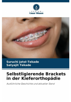 Selbstligierende Brackets in der Kieferorthopädie