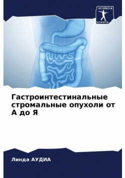 Гастроинтестинальные стромальные опухоли от А до Я