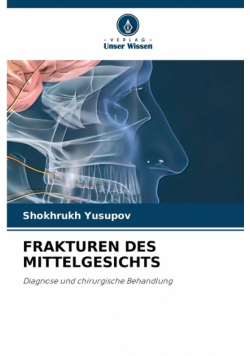 Frakturen Des Mittelgesichts