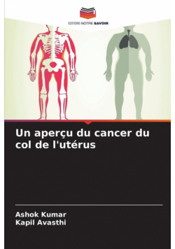 Un aperçu du cancer du col de l'utérus