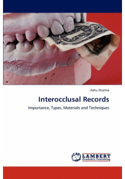 Interocclusal Records