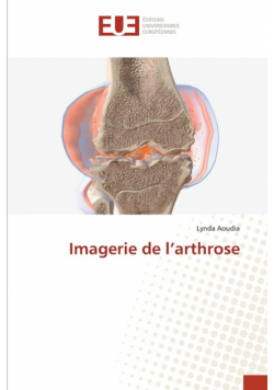 Imagerie de l'arthrose