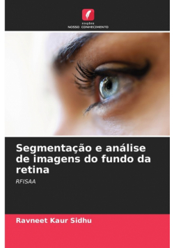Segmentação e análise de imagens do fundo da retina