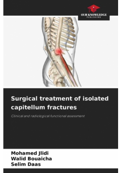 Surgical treatment of isolated capitellum fractures